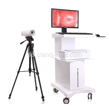 Medical Digital Portable Video Colposcope für die Gynäkologie